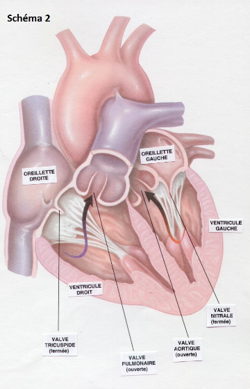 Dilatation d'une valve cardiaque dans le laboratoire de cathétérisme  cardiaque